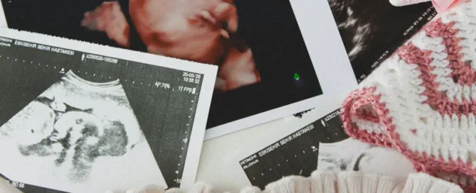 # FAQs – Alimentos Gravídicos: Quem Pode Pedir e Como a Justiça Define o Valor ## 1. Quem pode pedir alimentos gravídicos? A **gestante** pode pedir alimentos gravídicos durante a gravidez, em nome próprio, contra o suposto pai. O objetivo é ajudar a custear despesas da gestação. A análise depende do caso e da prova apresentada. --- ## 2. Precisa de exame de DNA para pedir alimentos gravídicos? Não necessariamente. Em regra, a Justiça analisa **indícios de paternidade**, como mensagens, fotos, testemunhas e contexto da relação. O exame de DNA pode ser discutido depois, se necessário. --- ## 3. O que os alimentos gravídicos cobrem? Podem incluir despesas da gravidez, como: * consultas e exames * medicamentos * alimentação especial * transporte * parto e internação O valor varia conforme a necessidade da gestante e a possibilidade financeira do réu. --- ## 4. Como a Justiça define o valor dos alimentos gravídicos? O juiz costuma avaliar dois pontos: * **necessidade da gestação** * **capacidade financeira do suposto pai** Não há valor fixo. Cada caso exige análise individual. --- ## 5. O pai precisa pagar metade de todas as despesas da gravidez? Não existe regra automática de 50%. A contribuição pode ser maior, menor ou proporcional, conforme as provas do processo, a renda das partes e os custos reais da gestação. --- ## 6. Alimentos gravídicos viram pensão alimentícia depois que o bebê nasce? Sim, em muitos casos. Após o nascimento, os alimentos gravídicos podem ser convertidos em **pensão alimentícia para a criança**, conforme prevê a legislação. --- ## 7. É possível pedir alimentos gravídicos mesmo sem casamento ou união estável? Sim. O pedido não depende de casamento ou união estável formal. O que importa é a existência de **indícios de paternidade** e a demonstração das despesas relacionadas à gravidez. --- ## 8. O suposto pai pode contestar os alimentos gravídicos? Sim. Ele pode apresentar defesa, contestar os indícios de paternidade, questionar o valor pedido e demonstrar sua realidade financeira. A decisão dependerá das provas do processo. --- ## 9. O pedido de alimentos gravídicos pode ser feito a qualquer momento da gravidez? Em regra, sim, desde que a gestação ainda esteja em curso. Quanto antes houver orientação jurídica e organização dos documentos, maior a chance de o pedido ser analisado em tempo útil. --- ## 10. O que fazer se a gestante não recebe ajuda financeira durante a gravidez? É importante reunir exames, comprovantes de despesas e indícios de paternidade. Com esses documentos, a situação pode ser avaliada juridicamente. Cada caso deve ser analisado com cuidado, especialmente por envolver direitos sensíveis.